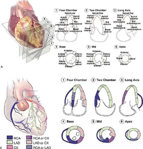 lv long wall|myocardial wall.